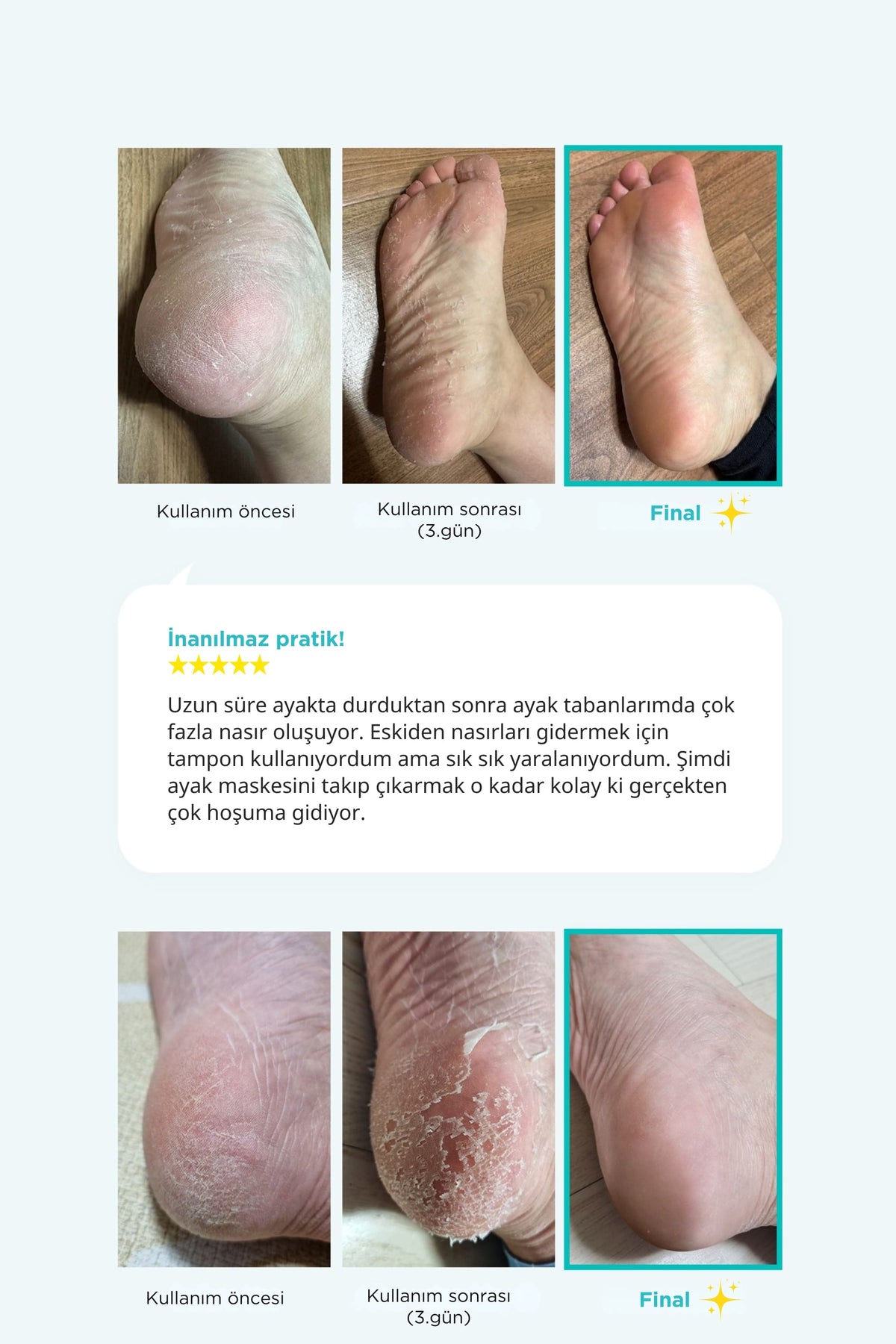 Ariul-Çorap Tipi Ayak Peeling Maskesi 2 Çift-Peeling-6-roqelvaxirum.shop