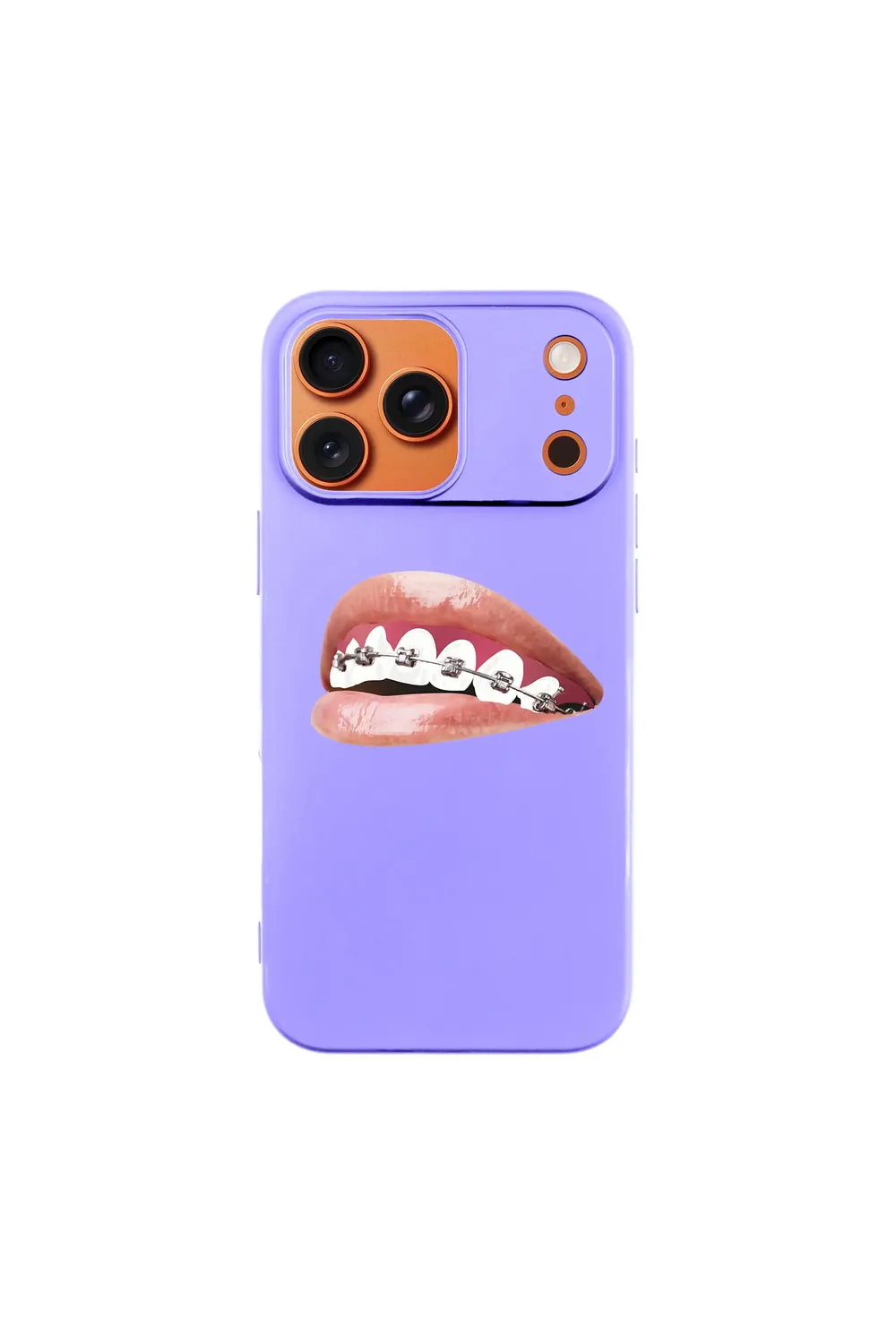 Orthodontist-Ultra Silikon Kılıf-Iphone 16 Plus - 6