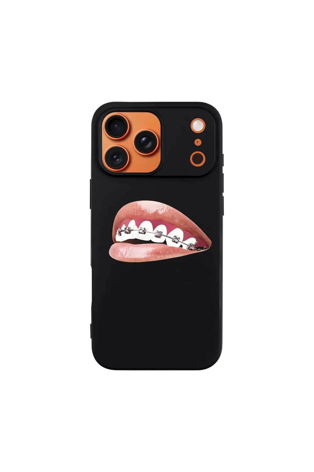 Orthodontist-Ultra Silikon Kılıf-Iphone 17 Pro Max - 3