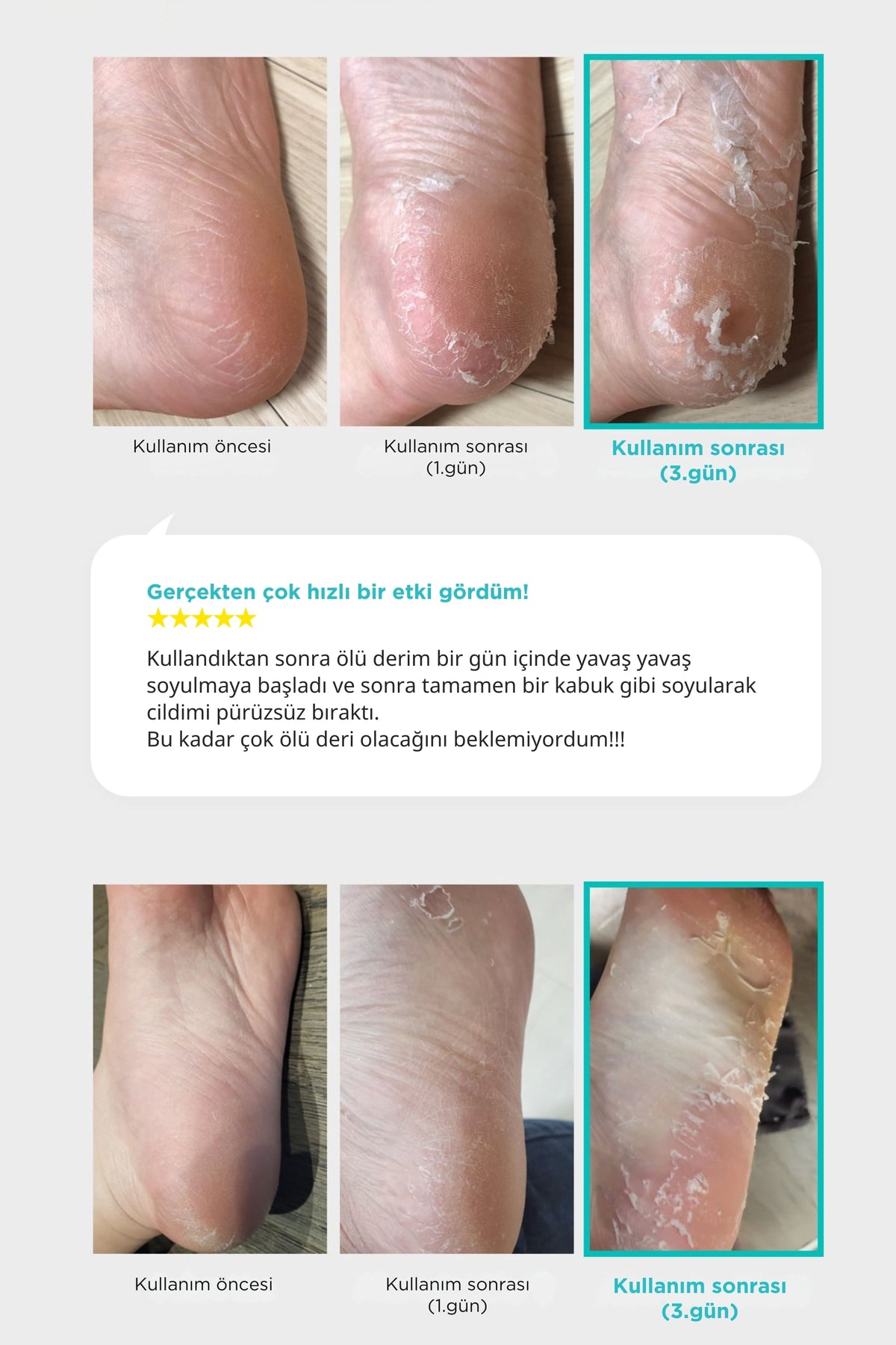 Ariul-Çorap Tipi Ayak Peeling Maskesi 2 Çift-Peeling-5-roqelvaxirum.shop